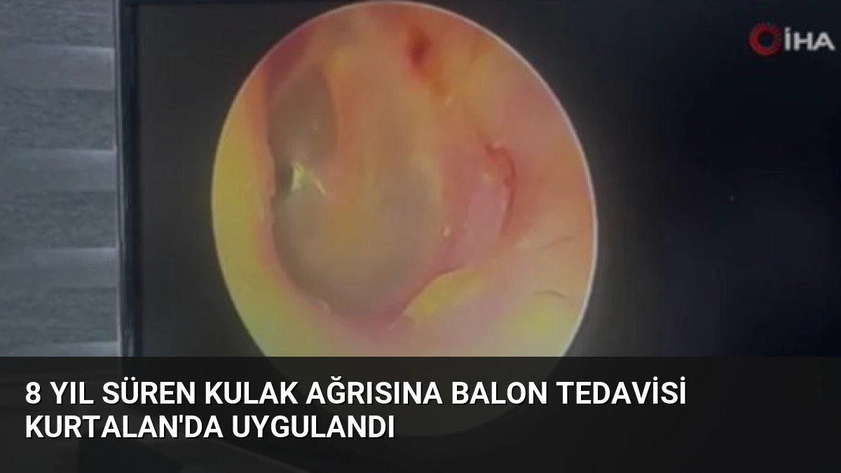 8 Yıl Süren Kulak Ağrısına Balon Tedavisi Kurtalan’da Uygulandı