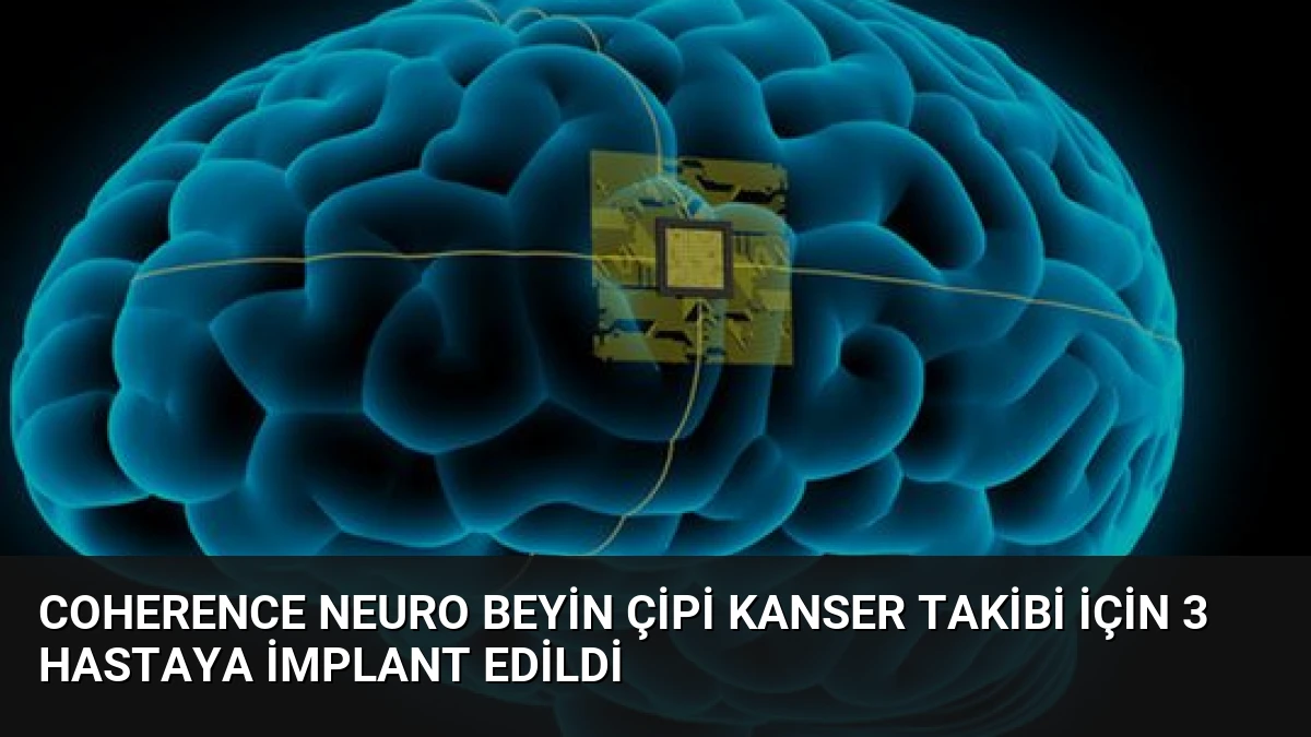 Coherence Neuro Beyin Çipi Kanser Takibi İçin 3 Hastaya İmplant Edildi