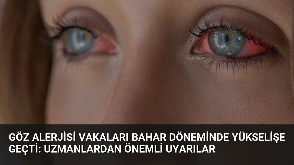Göz Alerjisi Vakaları Bahar Döneminde Yükselişe Geçti: Uzmanlardan Önemli Uyarılar