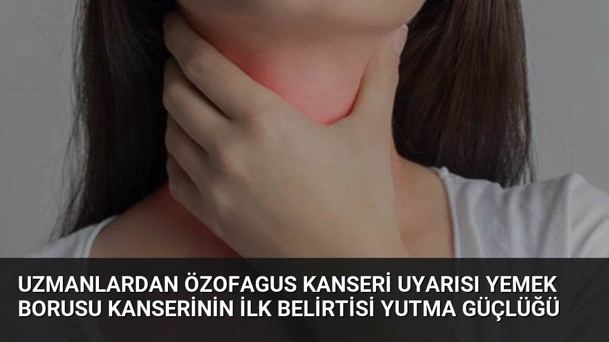 Uzmanlardan Özofagus Kanseri Uyarısı Yemek Borusu Kanserinin İlk Belirtisi Yutma Güçlüğü