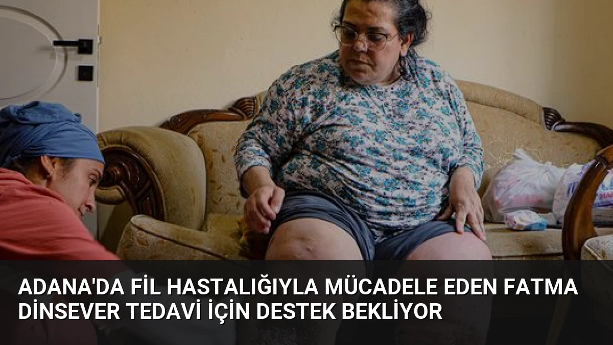 Adana’da Fil Hastalığıyla Mücadele Eden Fatma Dinsever Tedavi İçin Destek Bekliyor