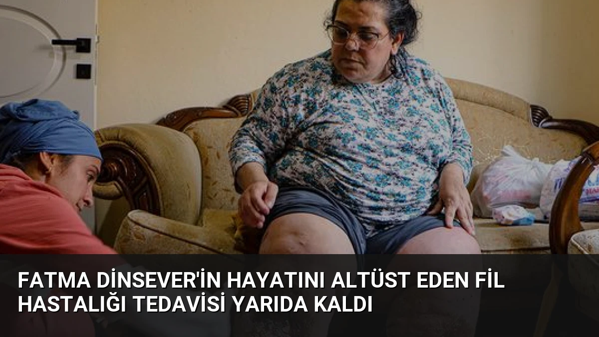 Fatma Dinsever’in Hayatını Altüst Eden Fil Hastalığı Tedavisi Yarıda Kaldı
