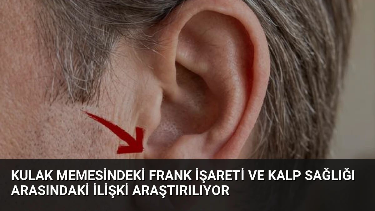 Kulak Memesindeki Frank İşareti ve Kalp Sağlığı Arasındaki İlişki Araştırılıyor