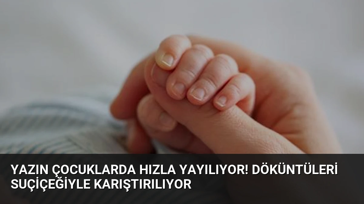 Yazın çocuklarda hızla yayılıyor! Döküntüleri suçiçeğiyle karıştırılıyor