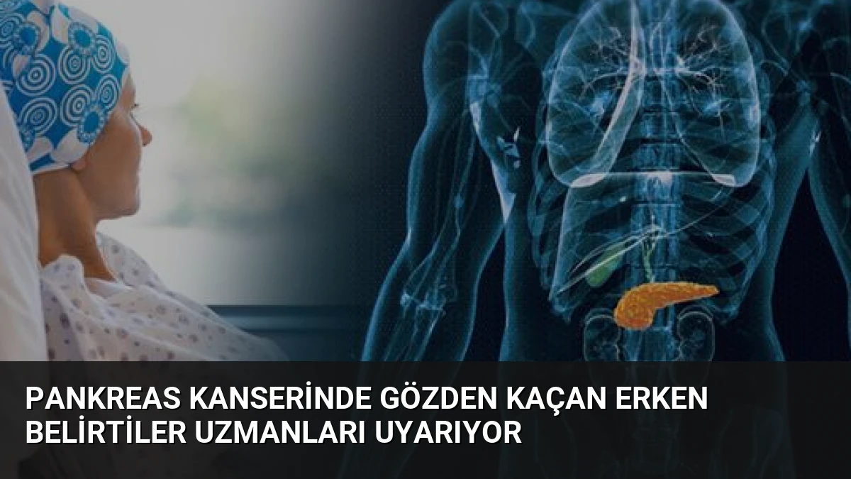 Pankreas Kanserinde Gözden Kaçan Erken Belirtiler Uzmanları Uyarıyor