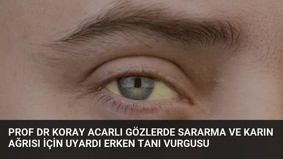 Prof Dr Koray Acarlı Gözlerde Sararma ve Karın Ağrısı İçin Uyardı Erken Tanı Vurgusu